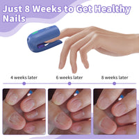 HaSoCare Nail Fungus Device, Fungal Nail Treatment, Antigungal Device for Toenail Fingernail and Onychomycosis