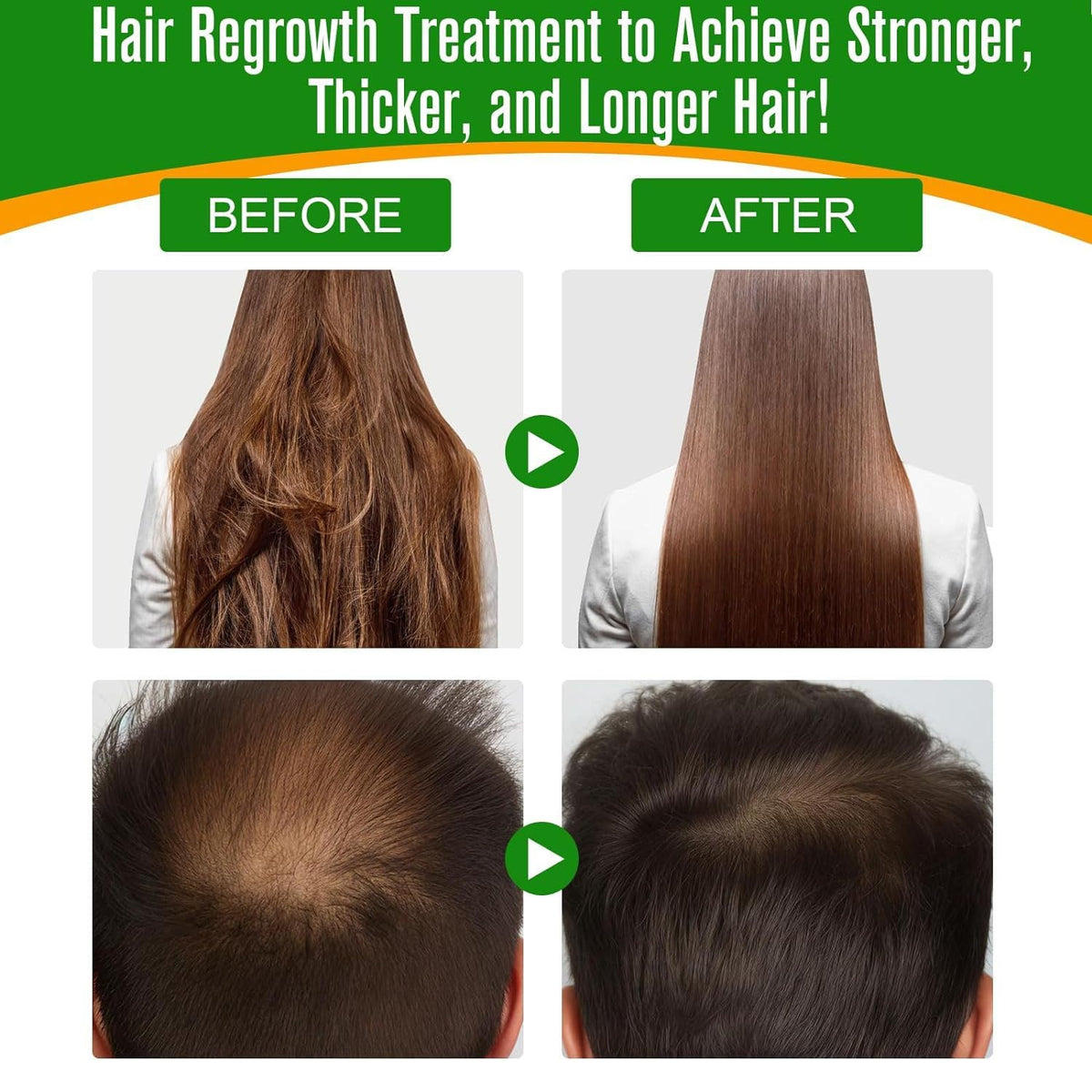 QUIWEN Batana Oil for Hair Growth & Skin Care, 100% Pure & Natural Batana Oil, Prevents Hair Loss, Repairs Damaged Hair & Skin, eliminates Split Ends & Increases Shine