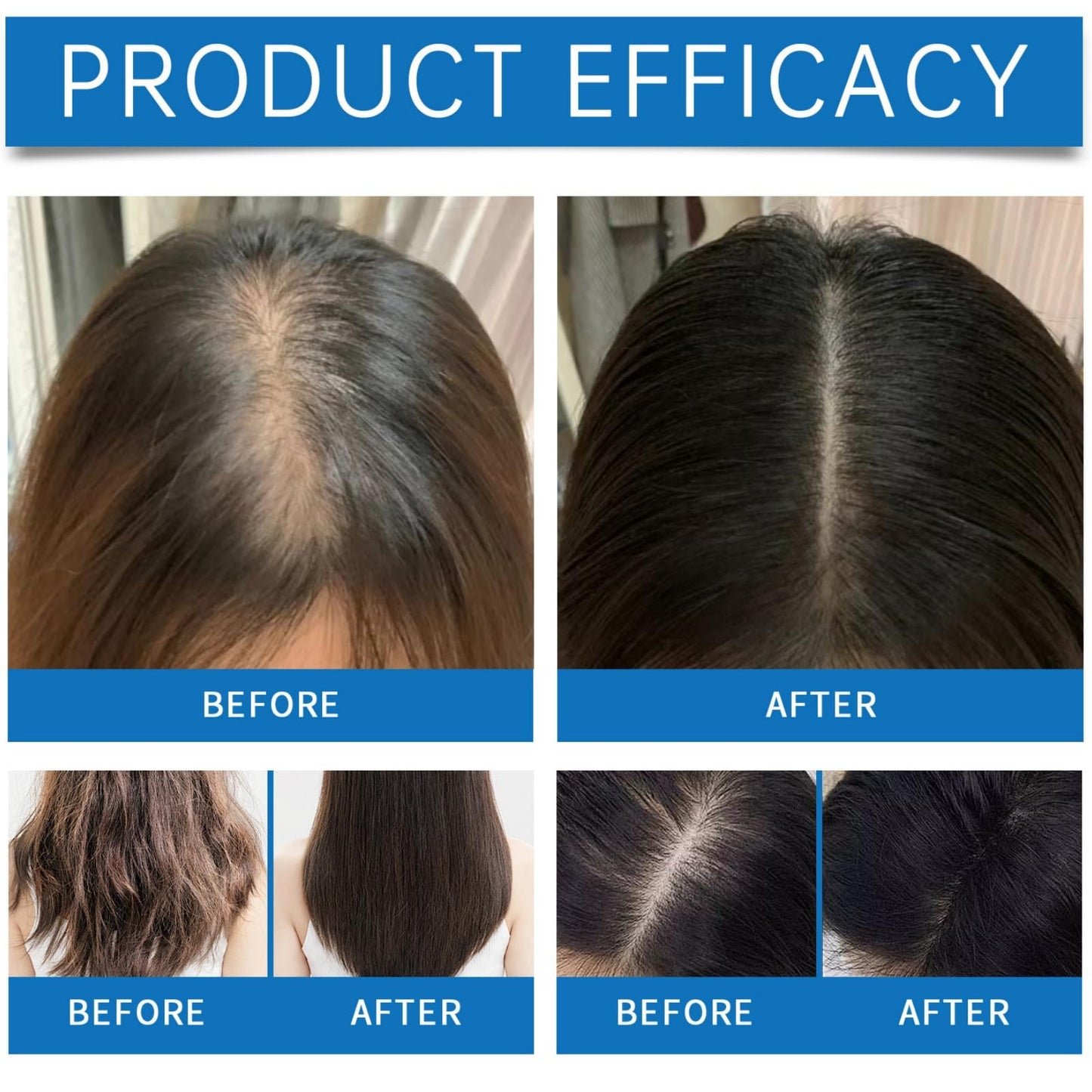 SingHao Scalp Cooling Hair Ampoule,H/air Growth Serum Roll On,S/calp Hair Ampoule,Hair Serum Helps to Ha/ir Growth,Hair Oil for Hair Growth,Hair Loss Treatment,Hair Growth Roller,Improve Scalp Health