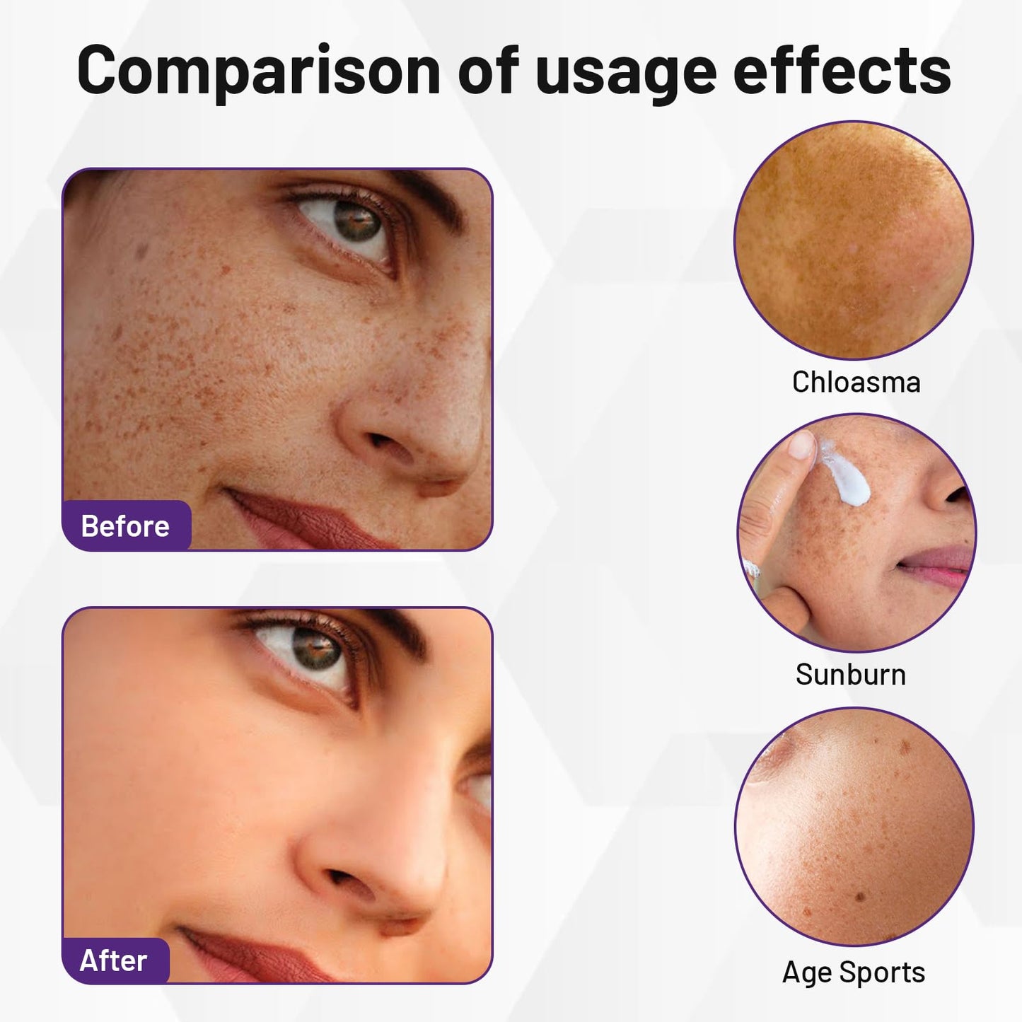 Ninnyi 30g Advanced Anti-Hyperpigmentation Cream, Dark Spots Remover Cream with Facial Massage Board