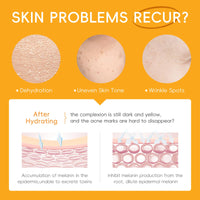 LAIKOU Skincare Set, Vitamin C Serum for Face Kit, Cleanser, Toner, Face Serum, Eye Cream, Essence Cream & Sunscreen, Anti Aging Radiance Gift Set for Women Teenage Girls Christmas Gifts, 6PCS