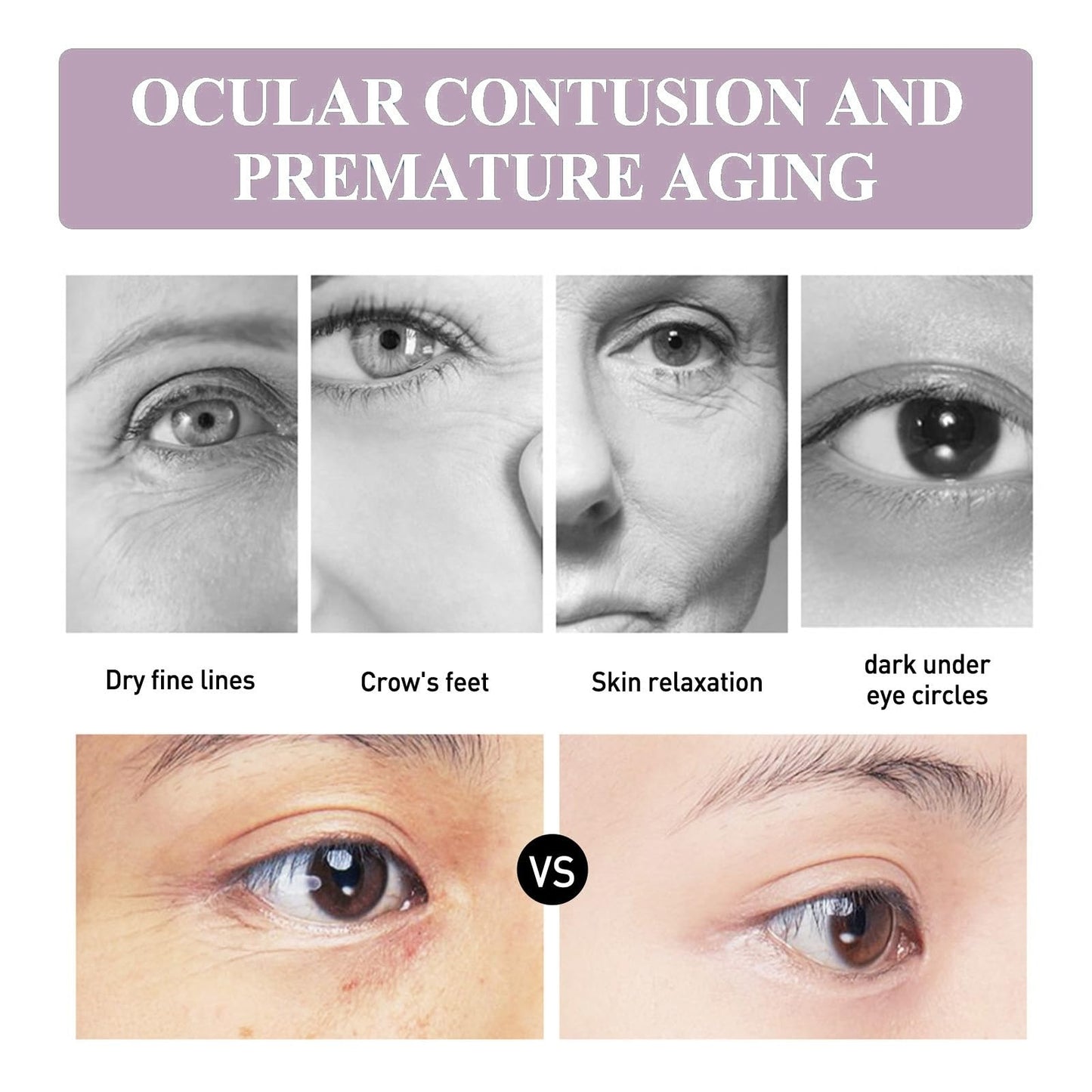 ShengQiu Lutein Eye Essence Oil, VC Rollerball Eye Serum,Anti Aging E/ye Cream for Dark Circles,Wrinkles & Puffiness,Vitamin C E/ye Seru/m for Men and Women, Ey/e Bags Remover,Anti Wrinkle Under Ey/e Cream