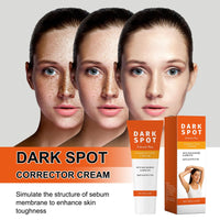OKAQEE Dark Spot Corrector for Face and Body - Intimate Areas Spot Cream with Niacinamide - Dark Spot Remover for Face - Freckle Removal Cream for Women - Improve Skin Dullness, Fade Spots Blemishes - 60g