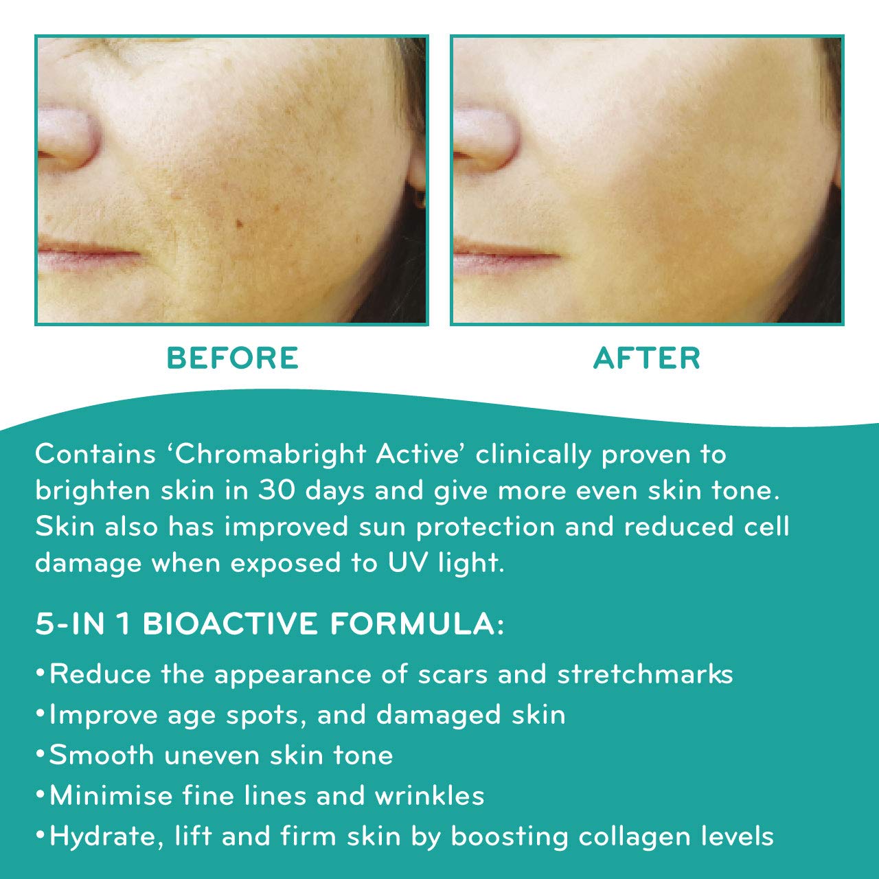 SkinWorks® Natural Superfood Rosehip Facial Oil Anti Ageing Treatment to Help Acne Scars, Stretch Marks and Fine Lines on Face 30ml