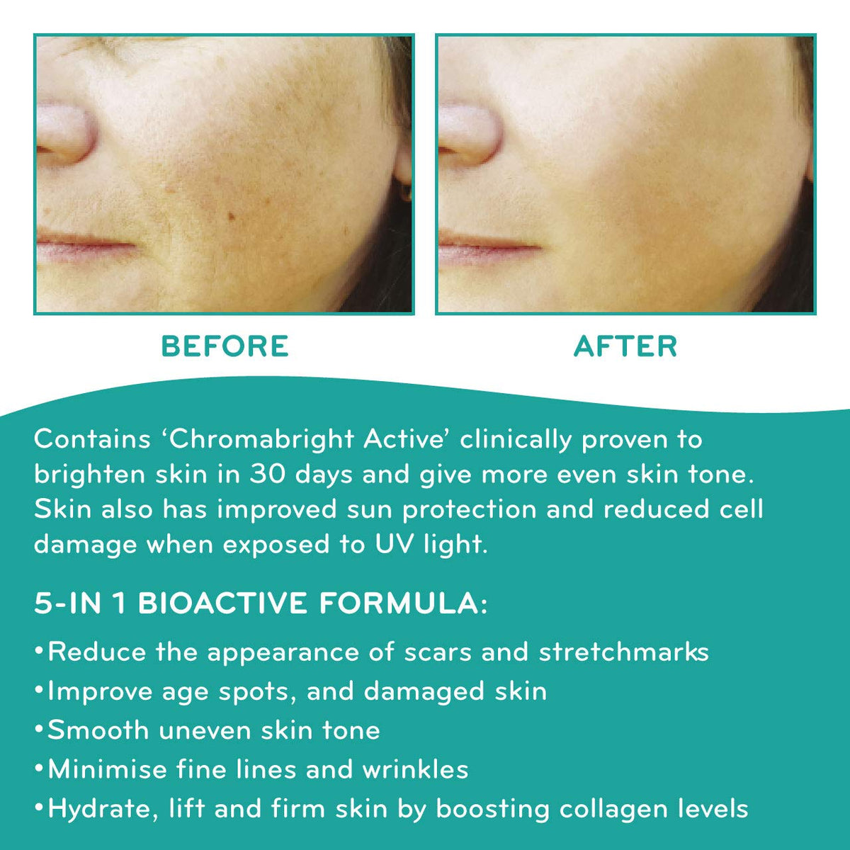 SkinWorks® Natural Superfood Rosehip Facial Oil Anti Ageing Treatment to Help Acne Scars, Stretch Marks and Fine Lines on Face 30ml