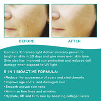SkinWorks® Natural Superfood Rosehip Facial Oil Anti Ageing Treatment to Help Acne Scars, Stretch Marks and Fine Lines on Face 30ml