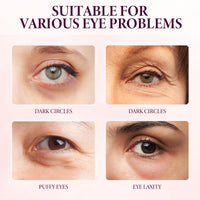 SingHao Eyelift Serum Mango Revitalize Eye Cream,Mango Activating and Firming Eye Cream,E/ye Cream for Dark Circles and Puffy Ey/es,Ey/e Cre/am Anti Aging,Vitamin C E/ye Cre/am,E/ye Bags Remover,Ey/e Gel