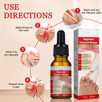 Ingrown Toenail Treatment Drop, Cuticle Care Oils for Ingrown Toenails, Trimming Toenail Softening Drops, Natural Ingrown Toenail Correction, Fungal Nail Treatment, Nail Growth Treatment, 30ml