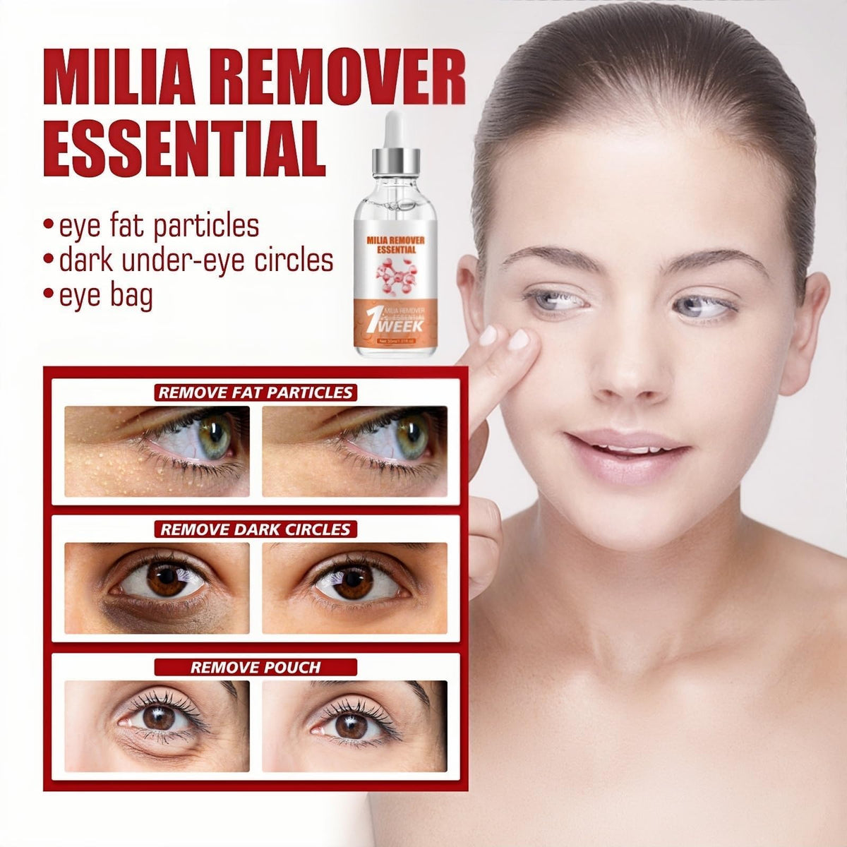 SEMECOMER Advanced Milia Remover Serum – Dual-Action Formula Soothes Milias, Dark Circles, Puffiness & Bags, Brightens & Tightens Under-Eye Area. Milia Removal Anti-Aging Treatment for Saggy Skin