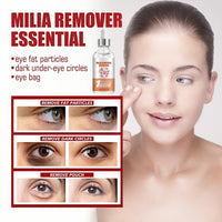 SEMECOMER Advanced Milia Remover Serum – Dual-Action Formula Soothes Milias, Dark Circles, Puffiness & Bags, Brightens & Tightens Under-Eye Area. Milia Removal Anti-Aging Treatment for Saggy Skin