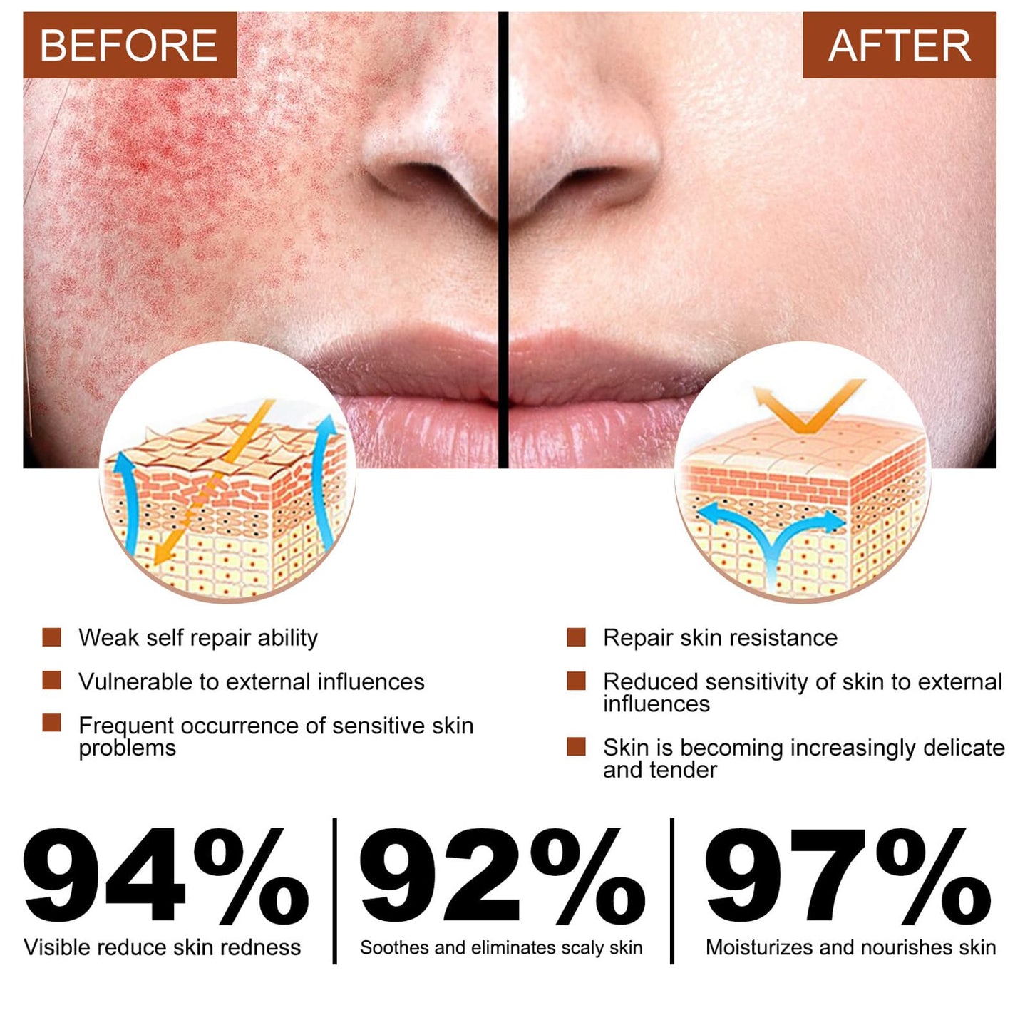 DMQ 2PCS Rosacea Face Serum,Anti Redness Face Serum,Tea Tree Anti Aging Serum for Face,Relieve Redness & Acne Mark,Natural Face Moisturizer for Sensitive Skin,Improve Skin Elasticity-Women & Men