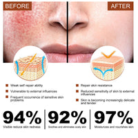 DMQ 2PCS Rosacea Face Serum,Anti Redness Face Serum,Tea Tree Anti Aging Serum for Face,Relieve Redness & Acne Mark,Natural Face Moisturizer for Sensitive Skin,Improve Skin Elasticity-Women & Men