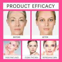 Kojic Acid Serum - Collagen Face Serum for Skin Lig_htening - Anti Aging Face Serum - Dark Spot Correcting Glow Serum - Hydrating Serum - Facial Serum for Firming, Moisturising, Nourishing (30ml)