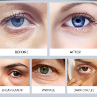 AmiCera Retinol Eye Cream, Eye Cream Anti Aging & Wrinkle, Repair Dark Circles Puffiness, Eye Bags Remover for Wommen and Men, Smooth Fine Lines, Under Eye Brightener, Long-lasting Hydration, 3G/0.11OZ