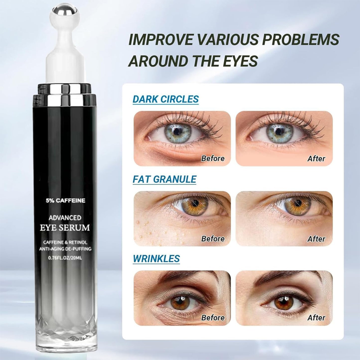 Caffeine Eye Serum - Caffeine Solution 5% Eye Cream, Under Eye Brightener, Eye Cream for Dark Circles and Puffiness with 360° Massage Ball, Fade Fine Lines Wrinkles, Retinol Anti-Ageing De-Puffing