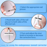 Professional Ingrown Toenail Treatment Kit, Podiatry Tools with Corrector Braces,Nail File and Lifter,Pain Relief Patches,Curved Toenail Corrector for Women Men