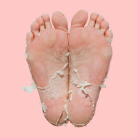 Skin Republic Pedi Foot Peel Max 15% stronger acids removes severely dry skin and cracked heels.