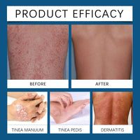 Soneat Magnesium Cream, Skin Treatment Cream, Gentle Repair Care, Effective joint Relief Pa-in for Whole Body, Highly Concentrated Magnesium for All Skin Types