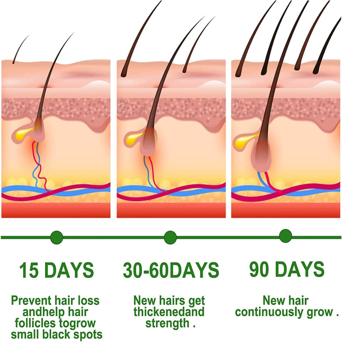KAIYOCA 2 Packs Pure Natural Rosemary Essential Oils, Hair Growth Scalp Oil for Dry Damaged Hair, Hair Loss Treatment, Nourishes The Scalp, Rid of Itchy & Dry Scalp