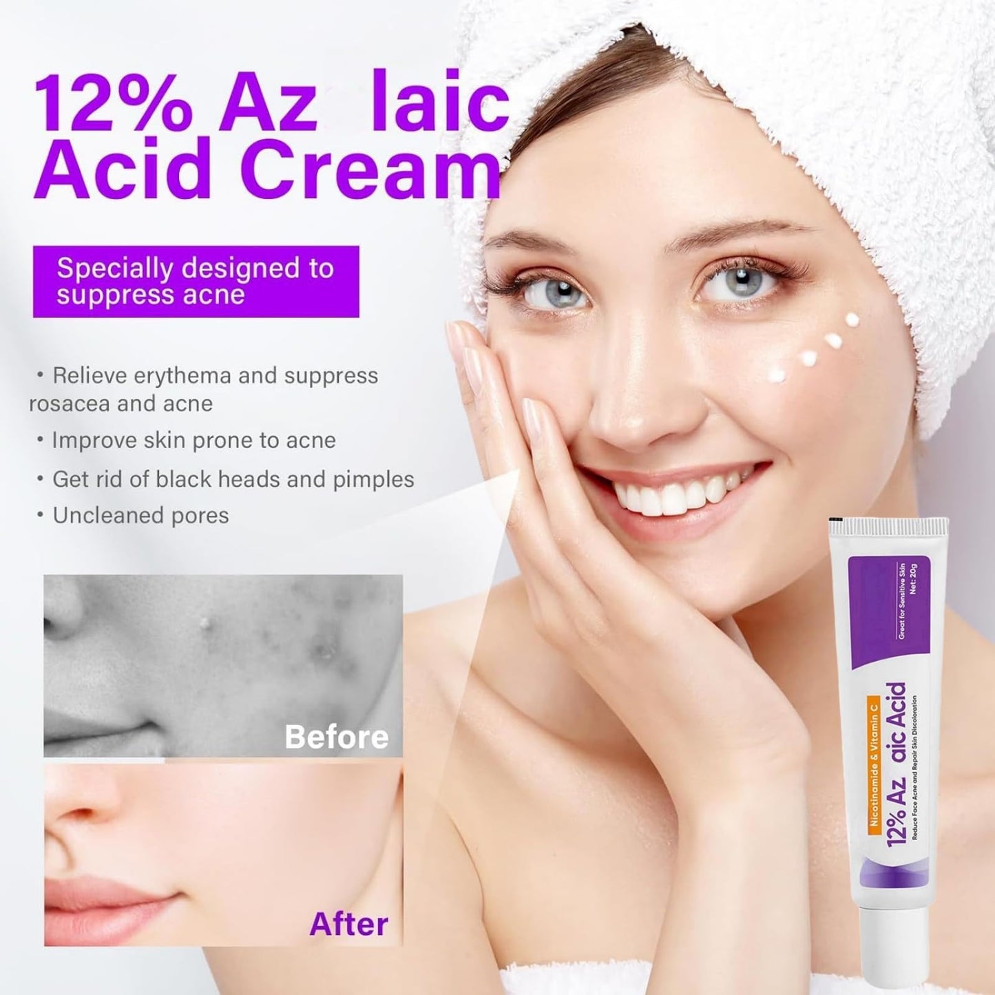 SingHao 2pcs Spot Cream,Acid 12% Facial Serum Cream,Azela-Ic Acid Face Cream,Night Cream Face Moisturiser,12% Ac/id Pimple Crea/m Spot Treatment,Azela-Ic Aci/d Serum for Face,Acne Treatment for Spo/t Prone