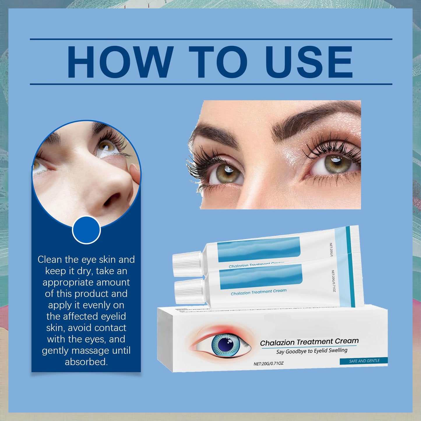 MINSHZEE Chalazion and Blepharitis Eye Cream - soothes eyelid swelling, redness and irritation - treats blisters, bags and dry chalazion - a gentle eye cream for daily eye care 2pcs