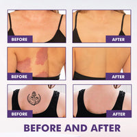 SHEBEEDO All-Over Complexion Perfector,Body Coverage Perfector for Legs,Tattoo Cover Up Makeup Foundation, Body Makeup, Hydrating Full Coverage Concealer, Evens Skin Toneand Light Foundation