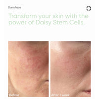 DAISYFACE Brightening Face Exfoliator 30ml – Gentle Exfoliation with Daisy Stem Cells, Bamboo Powder & AHAs – For Smooth, Radiant Skin