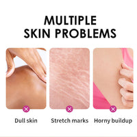 Yellow Peeling Oil - Lightening Exfoliating Dark Skin For Body, Strong Peeling Oil, Skin Peeling Oil For Skin Lightening, Peeling Oil For Skin Brightening Moisturizing, Peeling Solution Dark Skin