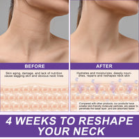 NBXINSLF AH-8 Firming Neck Cream, Neck Firming and Tightening With Roller, Reduces Neck Lines, Moisturizes, Tightens Skin, Hydrate & Boost Elasticity, Tightening Lotions Skin Repair for Women & Men