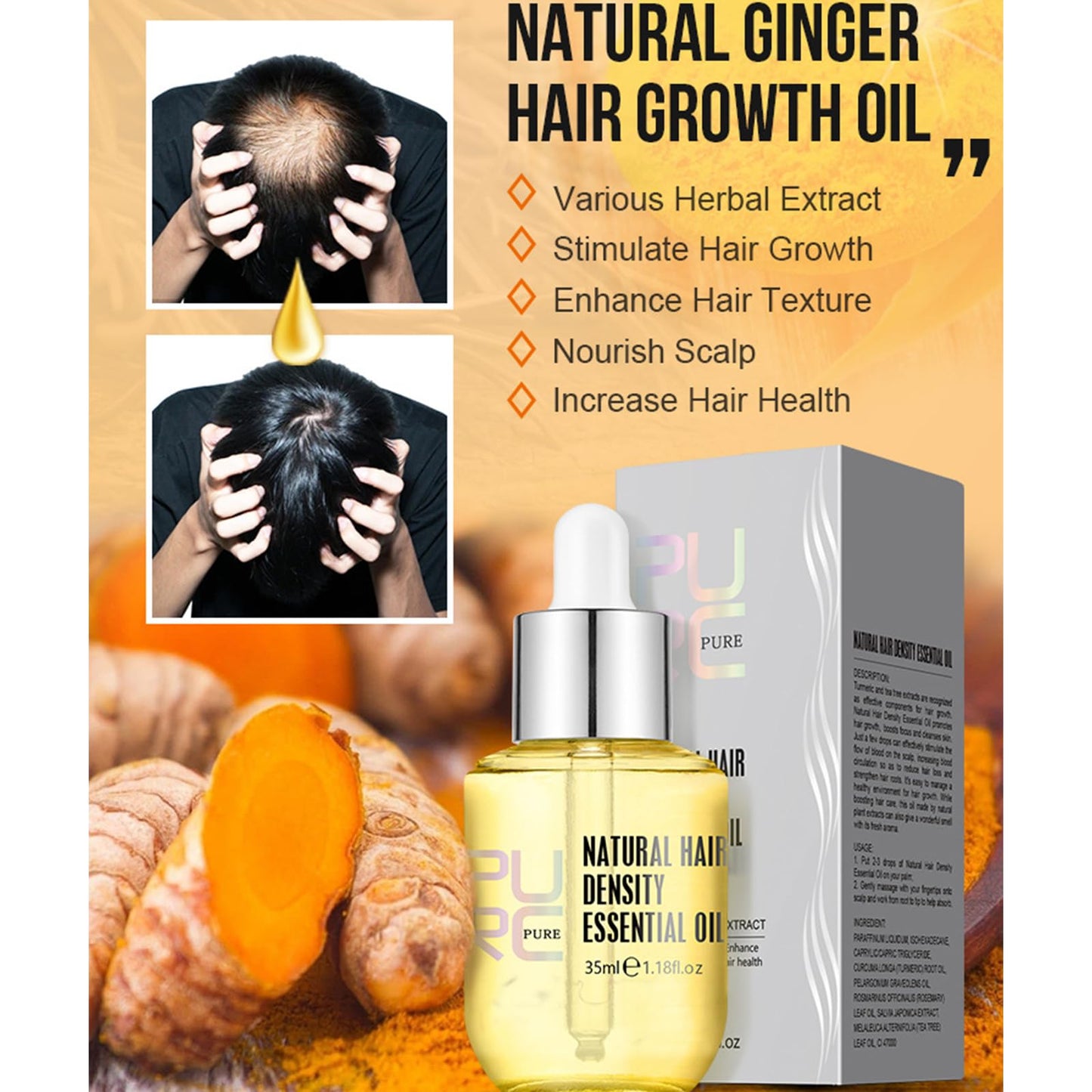 Hair Growth Serum Anti Hair Loss Hair Serum Ginger Regrowth Hair Oil For Thinning Balding,Thin Hair,Fast Growth,Repairs Follicles Stronger Hair For Men & Women,35ml (1pc)