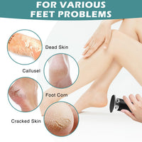 atnayo Electric Foot File Hard Skin Remover, Clean Brush and Foot Sander for Hard Skin Callus Dry