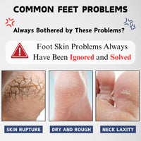 ISBEAUSOLS 40% Urea Cream, Urea Foot Cream for Cracked Heels And Dry Skin, Foot Care for Deeply Moisturizing & Nourishing, Urea Cream Softens Hand & Foot Skin, Foot Moisturiser for Women & Men, 150g