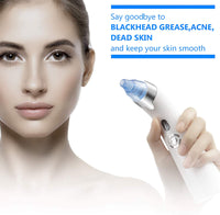 Senua Senelux Blackhead Remover Vacuum Pore Cleaner Acne Comedone Extractor Face Pore Vacuum Blackhead Remover Tool Facial Pore Cleanser with 5 Adjustable Suction Power and 4 Replacement Probes - Blue