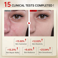 VGO Retinol Serum, Unique Double Active Ingredients of Retinol & Niacinamide, Outstanding Synthetic Effect to Reduce Wrinkle and Dark Circle 29ml