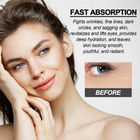 Vitamin C Eye Serum,Eye Cream for Dark Circles and Puffy Eyes,Under Eye Cream,Eye Bags Remover,Anti Wrinkle Vit C SerumFor Women/Men Anti Aging,Skincare for Dark Circles Under Eye Treatment Women