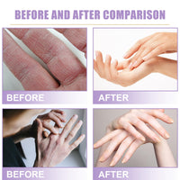 Maggikey Moisturizing hand mask contains lavender extract, lactic acid, shea butter, vitamin e and glycerin to help moisturize dry, rough skin 6 Lavender