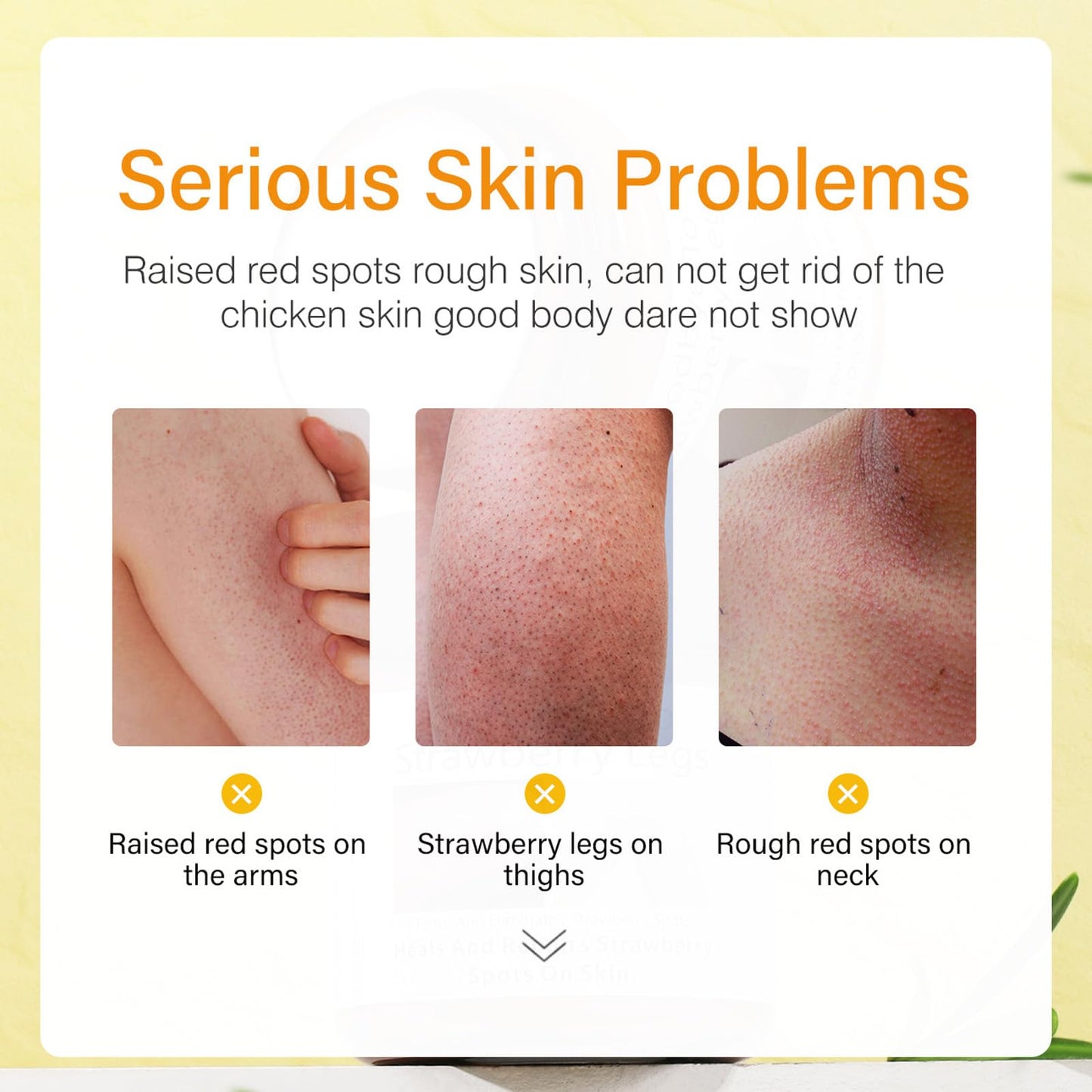 Pothenika Strawberry Legs Treatment Cream, Keratosis Pilaris Treatment, Anti Winkle Smoothing Face Body Moisturiser, Deep Nourishment Skin Exfoliating Repair Cream Fades Strawberry Skin,120g