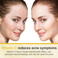 Vitamin C Face Cream – Hyaluronic Acid And Vitamin C&E,Face Moisturiser For Women,Anti Aging&Wrinkle,Natural Skin Care Hydrate,Plump,Brightening Skin Care Lighten Dark Spots Erase Fine Lines (1PCS)
