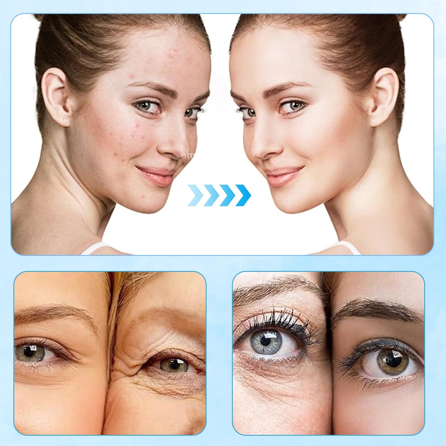 Ninnyi Micro Infusion Facial System With Serum Beauty Lips Kit for Repair Skin Deep Nourishment All Skin Types(5 PCS)