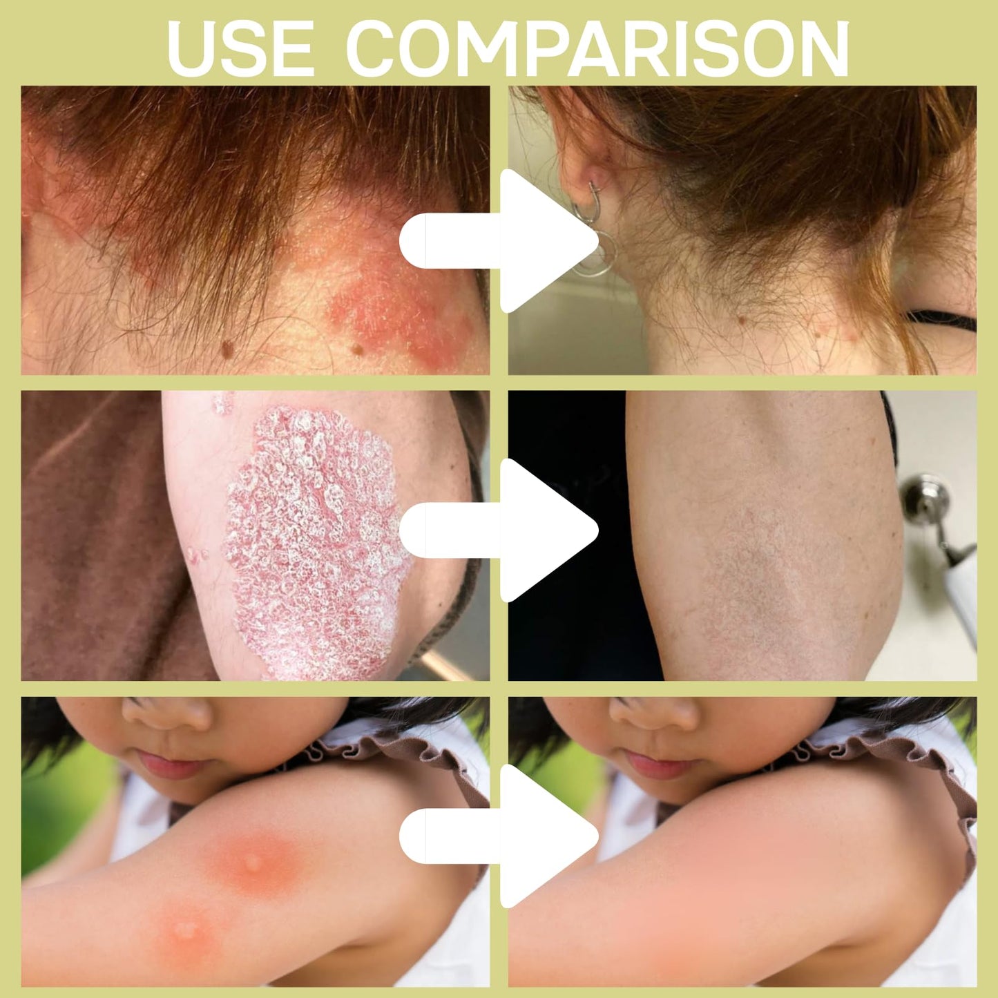 6PCS Chinese Body Cream,Clarifying Botanical Natural Face Cream Set,Soothing and Balancing Skin Smiles and Joys Cream,East Asia BodyCream for Skincare,VersatileCream Plant Essences For Dry Skin Relief