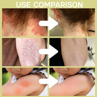 6PCS Chinese Body Cream,Clarifying Botanical Natural Face Cream Set,Soothing and Balancing Skin Smiles and Joys Cream,East Asia BodyCream for Skincare,VersatileCream Plant Essences For Dry Skin Relief