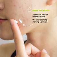 SVR SEBIACLEAR Hydra - Soothing 48hr Hydrating Face Cream for Acne-Prone, Oily, Combination Skin, Post-Acne Treatment Repairing Non-Comedogenic Moistiriser, 40ml