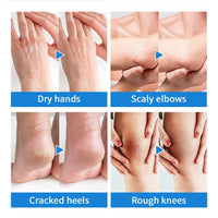 NLFOX 40% Urea Cream - 100g Cracked Heel Repair Cream For Elbows Knees Feet And Hand - Smooth Moisturize Urea Foot Cream With Foot And Body Care - Maximum Strength Callus Remover For Dry And Hard Skin