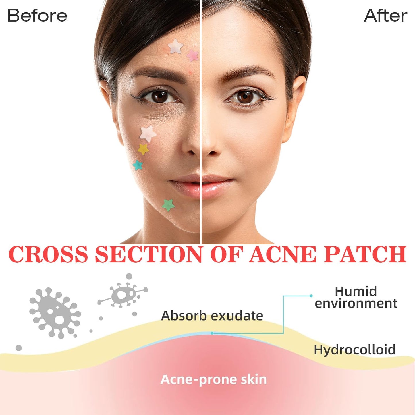 Home Holic Star 480 Pimple Patches Spot Patches Acne Treatment Absorbing Cover Invisible Blemish Cover Spot Sticker for Fast Acting Skincare