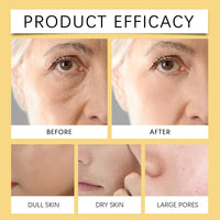 CiLiHai Anti-Wrinkle & Skin Tightening Facial Cream with B/ee Ven/om Formula,Day and Night B/ee Ven/om Cream for All Skin,Instant Lift & Hydration Cre/am for Mature Skin,Deep Nourishment and Wrinkle Reduction