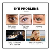 BigyQiu Rollerball Castor Oil,Under Eye Rollerball,Eye Cream for Dark Circles,Castor Oil and Frankincense Eye Roller Ball Oil,Anti Wrinkle Eye Cream,Firming Eye Cream,Eye Cream for Dark Circles