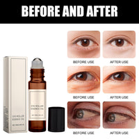 Liameph Castor Oil and Frankincense Roller Ball, Castor Oil Eye Roller Time Eraser Eye Care Products for Under Eye Area Lifts Firming(1pc, 10ml)