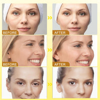 RuverLand 4 PCS Bee Venom Cream Anti-Wrinkle, Face and Neck Cream Moisturiser, Wrinkle Removal & Firming, Moisturizing, Lifting & Recovery for All Skin Type, Anti-Aging Bee Venom Cream