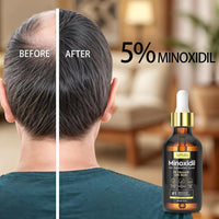 5% Minoxidil Hair Growth Serum Oil For Men and Women, Biotin Hair Serum, Prevent Scalp Hair Loss, 60 ml / 2.11 fl.oz