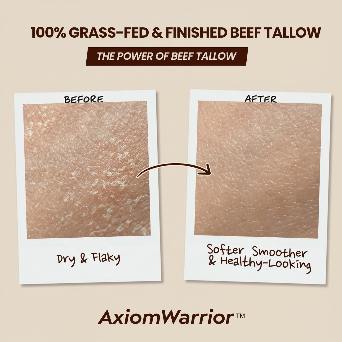 AxiomWarrior Beef Tallow Skin Care: Whipped Organic Beef Tallow Moisturizer Cream for Face & Body with Grass Fed & Finished - Hydrates, Smoothes, Nourishes Skin - Sensitive, Dry Skin - 2oz